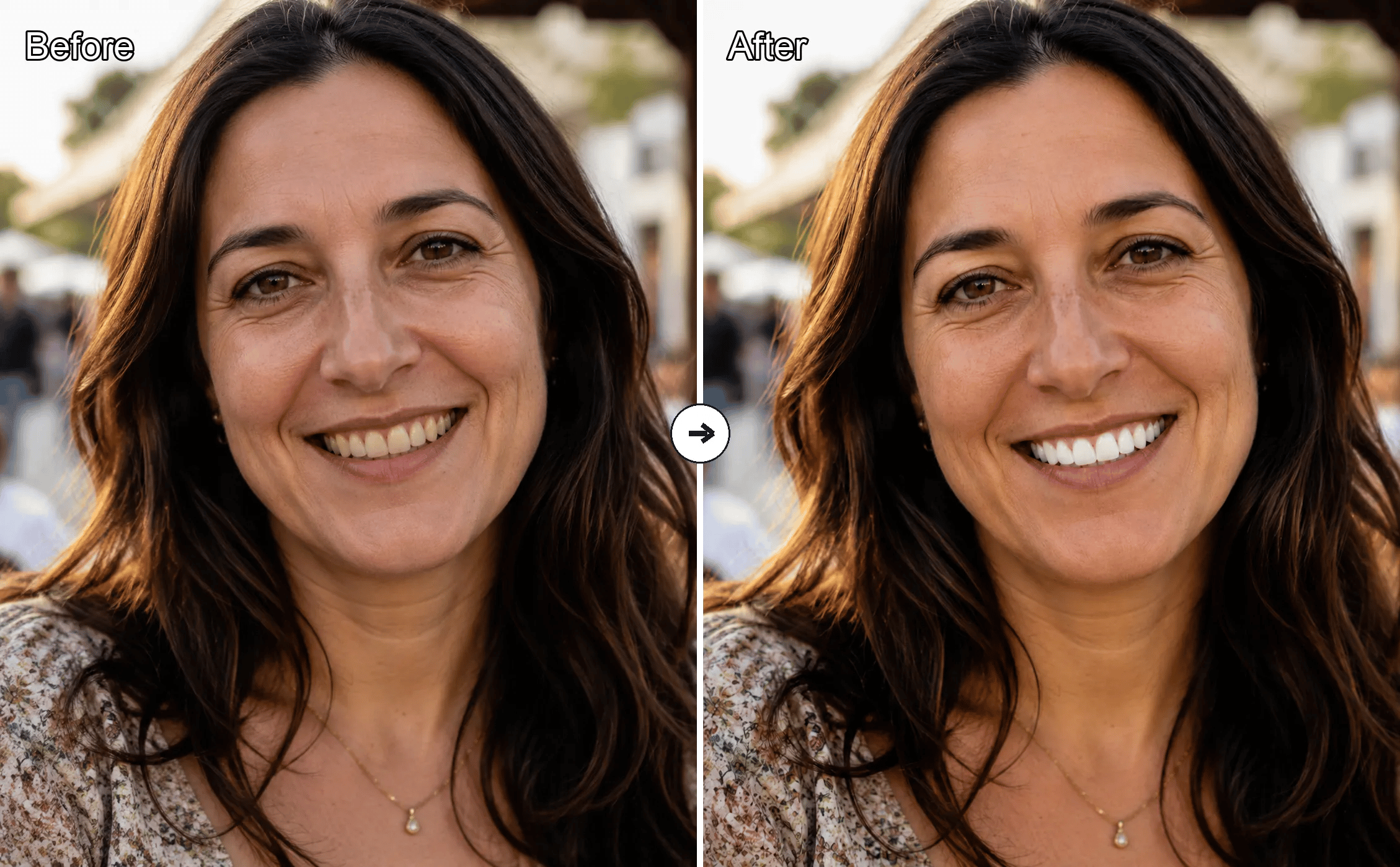 Free AI Teeth Whitening Online